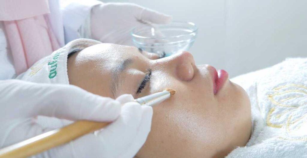 Peeling akne aufar