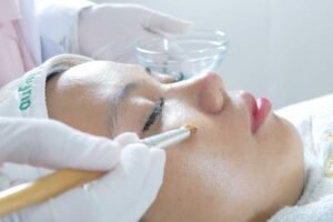 Peeling akne aufar