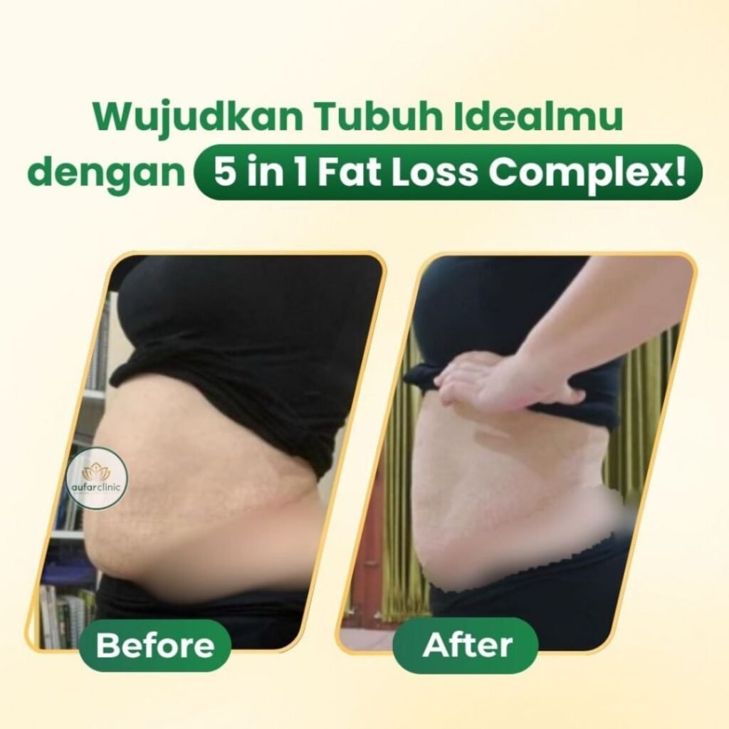 Program slimming aufar