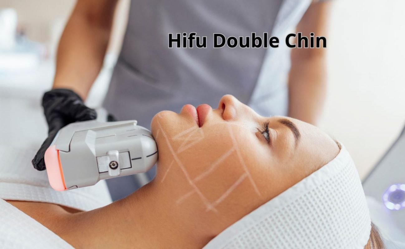 Hifu double chin Aufar